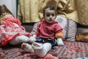 Dijete amputirac Gaza