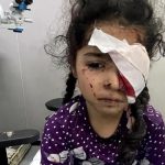 Više od 1500 ljudi u Gazi oslijepilo zbog izraelske agresije