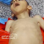 Gaza: Četverogodišnji dječak preselio od gladi