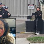 Australska političarka rizikuje gubitak vida nakon nasilnog hapšenja na pro-palestinskom protestu