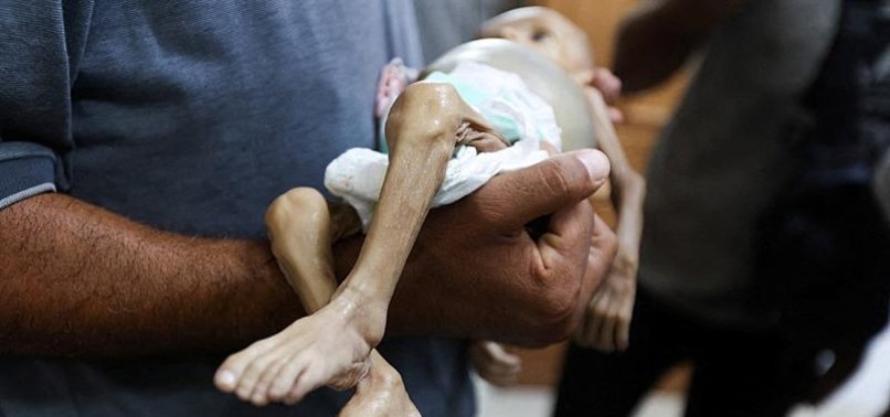 Gaza izgladnjivanje