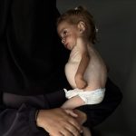 Nakon 9 godina neplodnosti – izraelska glad ubija djevojčicu Šam