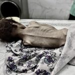 Osam umrlih od gladi u Gazi, UNRWA poziva na hitno slanje pomoći
