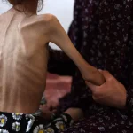 Još šehida zbog gladi u Gazi i šokantne statistike nakon 700 dana genocida